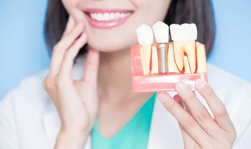 Family Dentistry of Forest Hill | How Dental Implants Have Evolved Over the Years: Technological Advances