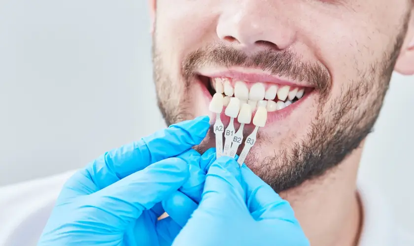 Family Dentistry of Forest Hill | Understanding Dental Veneers and Their Benefits