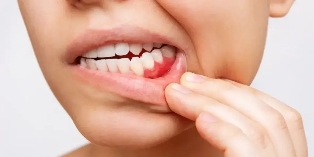 Family Dentistry of Forest Hill | Spooktacular Gum Disease Prevention: Why Regular Cleanings Matter More Than You Think Family Dentistry of Forest Hill | Spooktacular Gum Disease Prevention: Why Regular Cleanings Matter More Than You Think