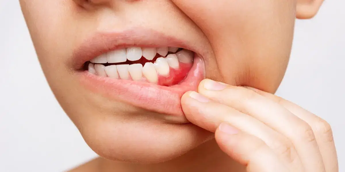 Family Dentistry of Forest Hill | Spooktacular Gum Disease Prevention: Why Regular Cleanings Matter More Than You Think