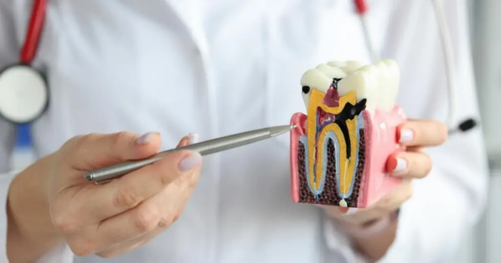 Family Dentistry of Forest Hill | Think You Might Need a Root Canal? Here’s When to Reach Out to a Dental Expert Family Dentistry of Forest Hill | Think You Might Need a Root Canal? Here’s When to Reach Out to a Dental Expert