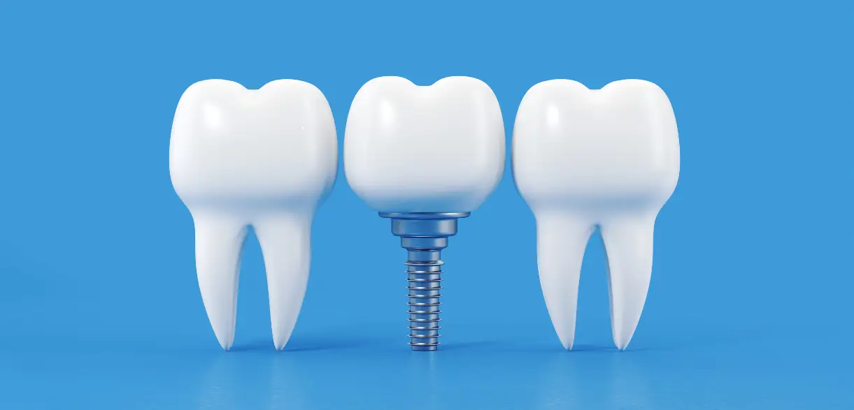 Family Dentistry of Forest Hill | Can You Get Dental Implants If You Have Gum Disease
