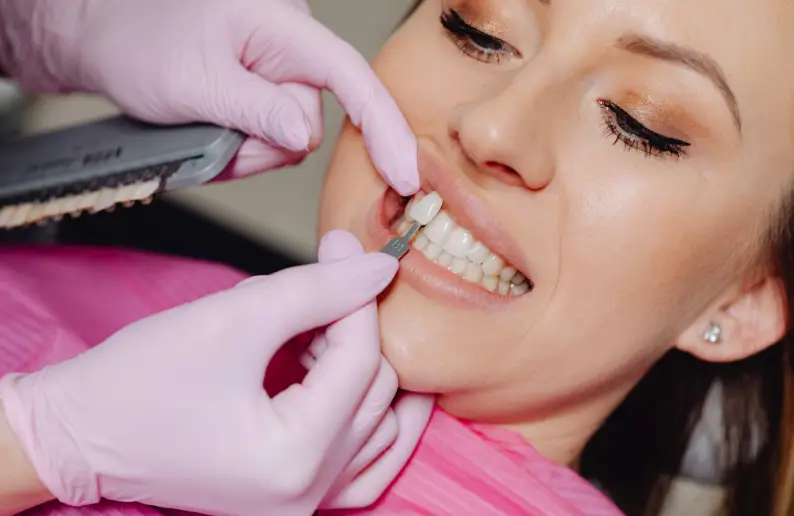 Family Dentistry of Forest Hill | How Long Do Dental Veneers Last? Maintenance and Longevity