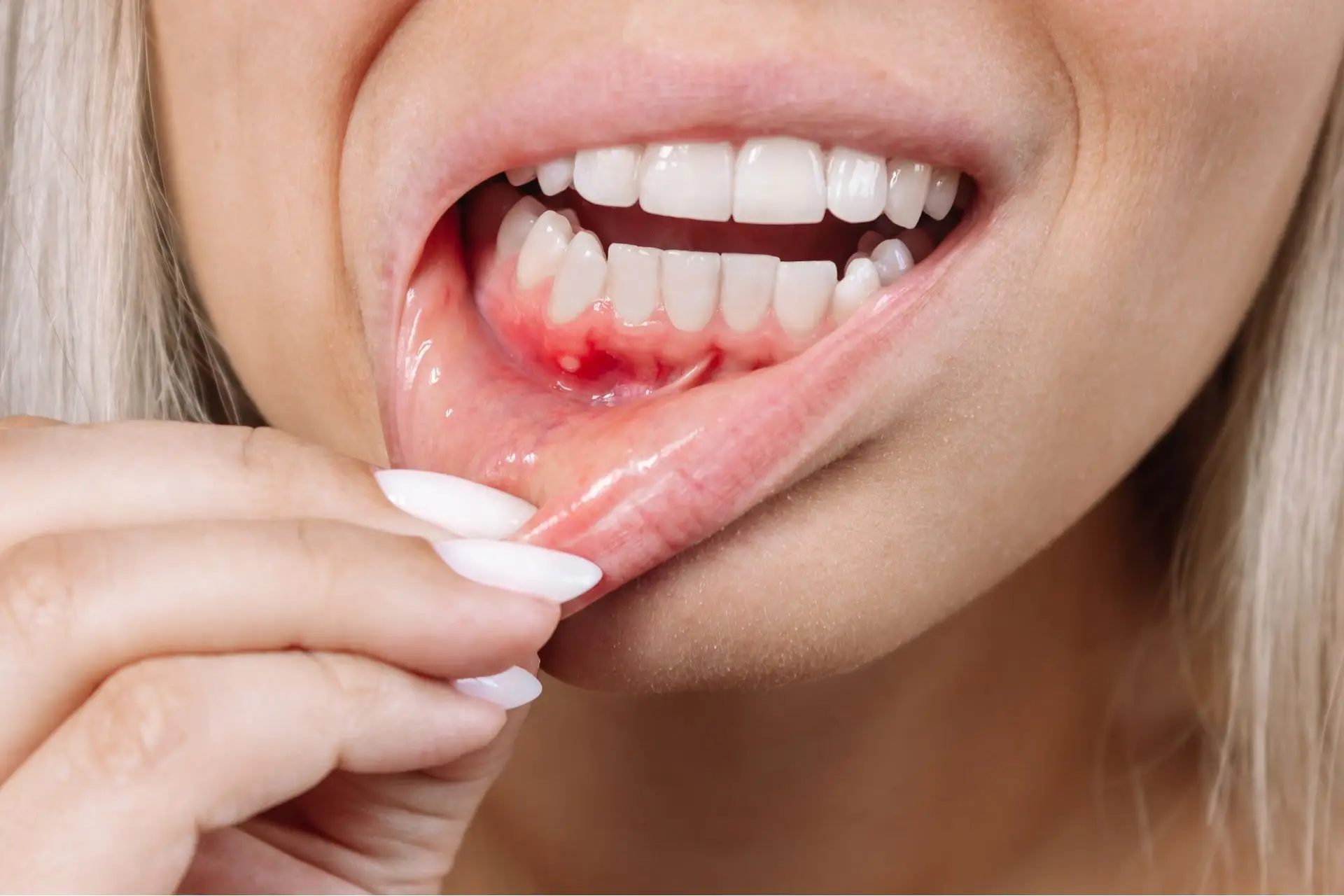 Family Dentistry of Forest Hill | Gum Disease & Your Health: Risks, Prevention, and Treatment