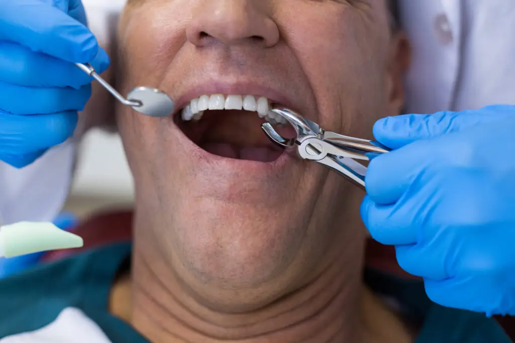 Family Dentistry of Forest Hill | Dry Socket After Tooth Extraction: Is It An Emergency? Family Dentistry of Forest Hill | Dry Socket After Tooth Extraction: Is It An Emergency?