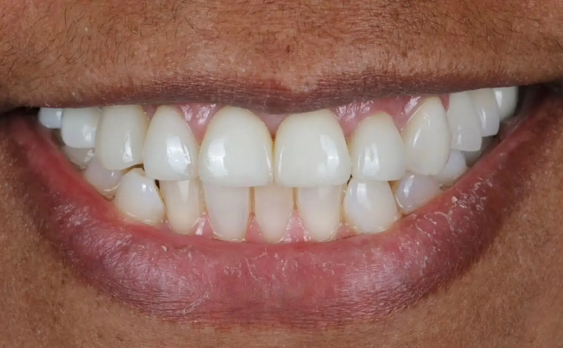 Family Dentistry of Forest Hill | Smile Gallery
