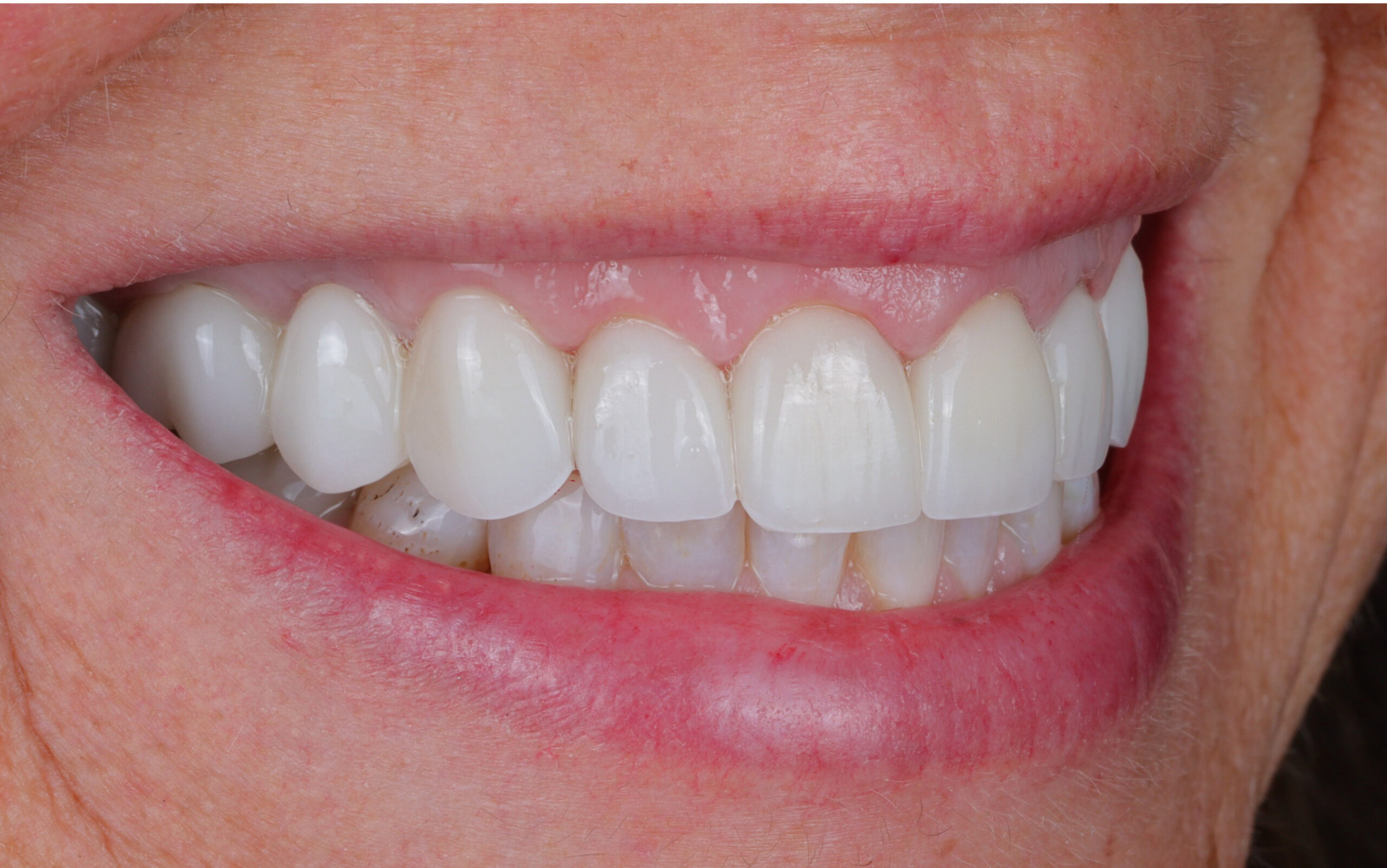 Family Dentistry of Forest Hill | Smile Gallery