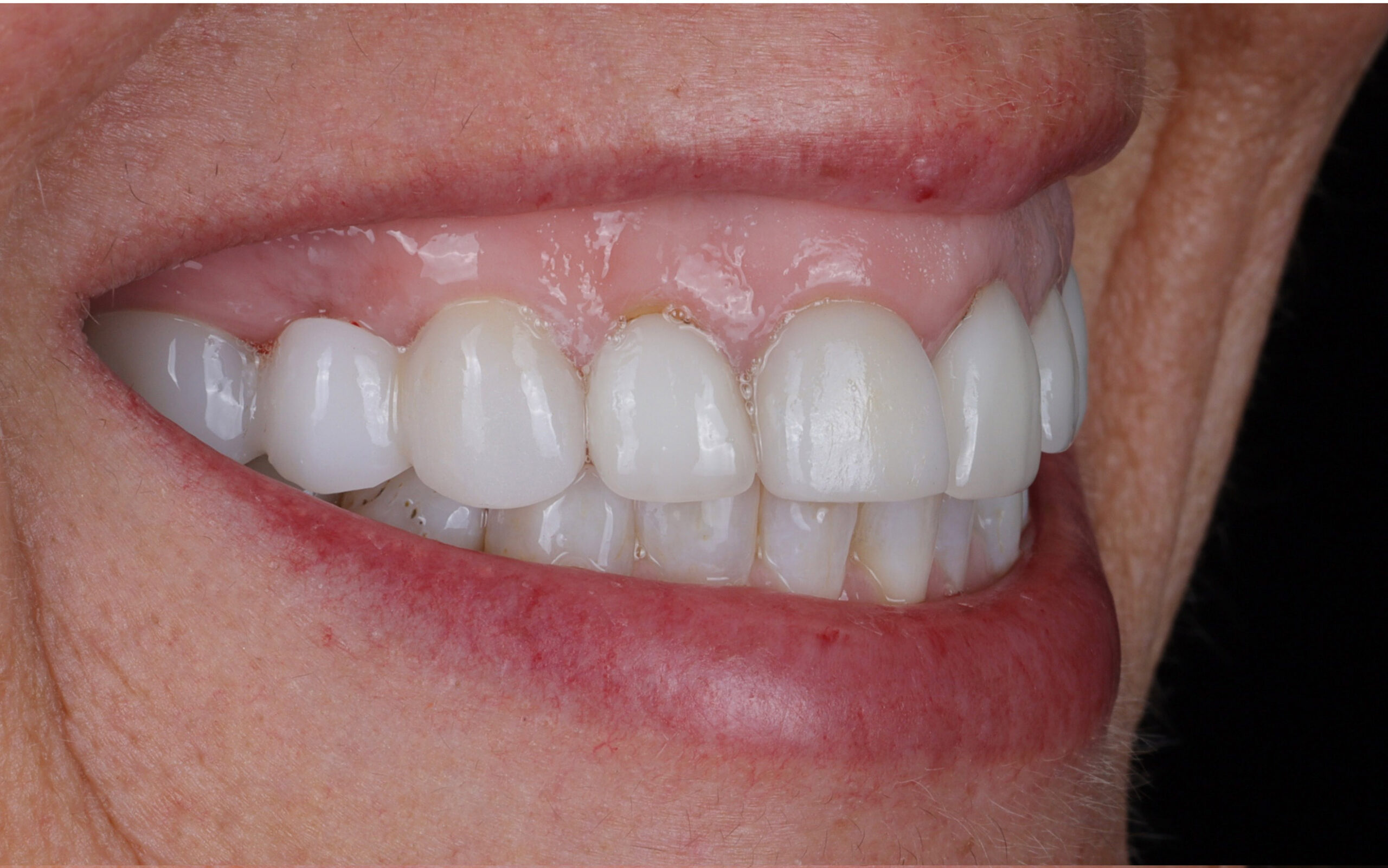 Family Dentistry of Forest Hill | Smile Gallery