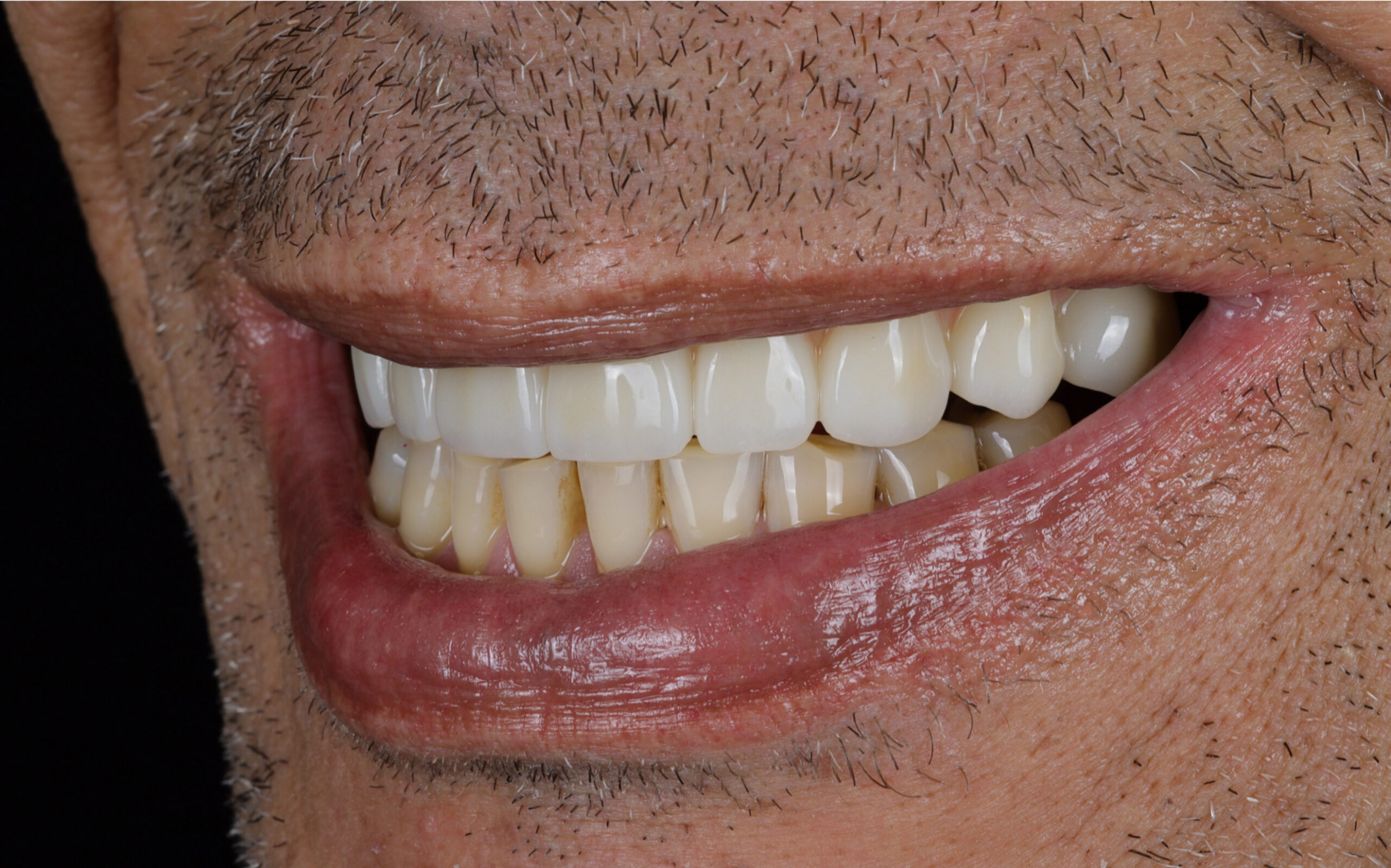 Family Dentistry of Forest Hill | Smile Gallery