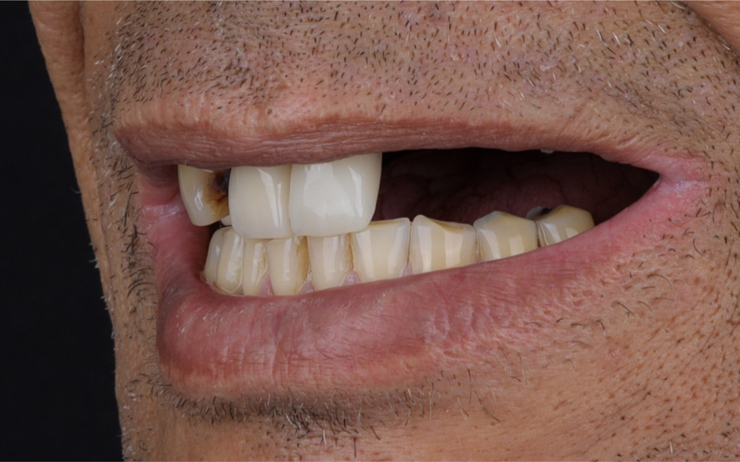 Family Dentistry of Forest Hill | Smile Gallery