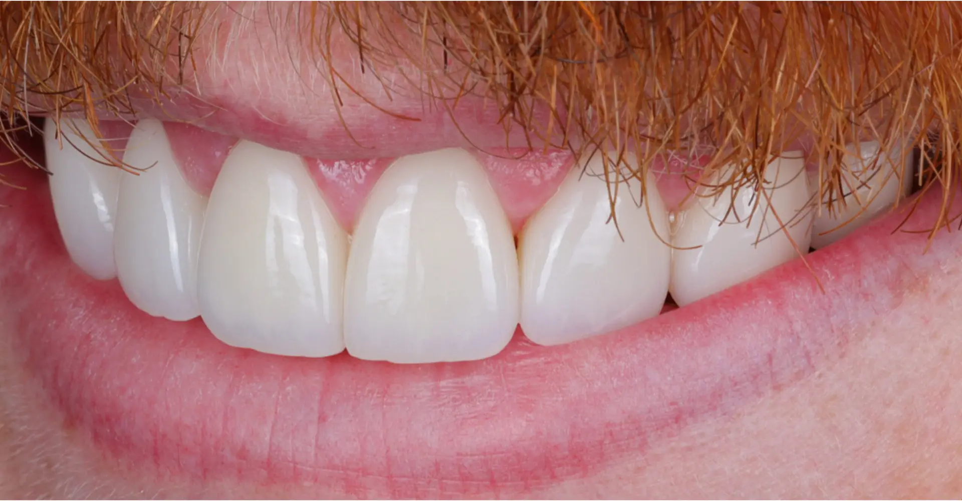 Family Dentistry of Forest Hill | Smile Gallery