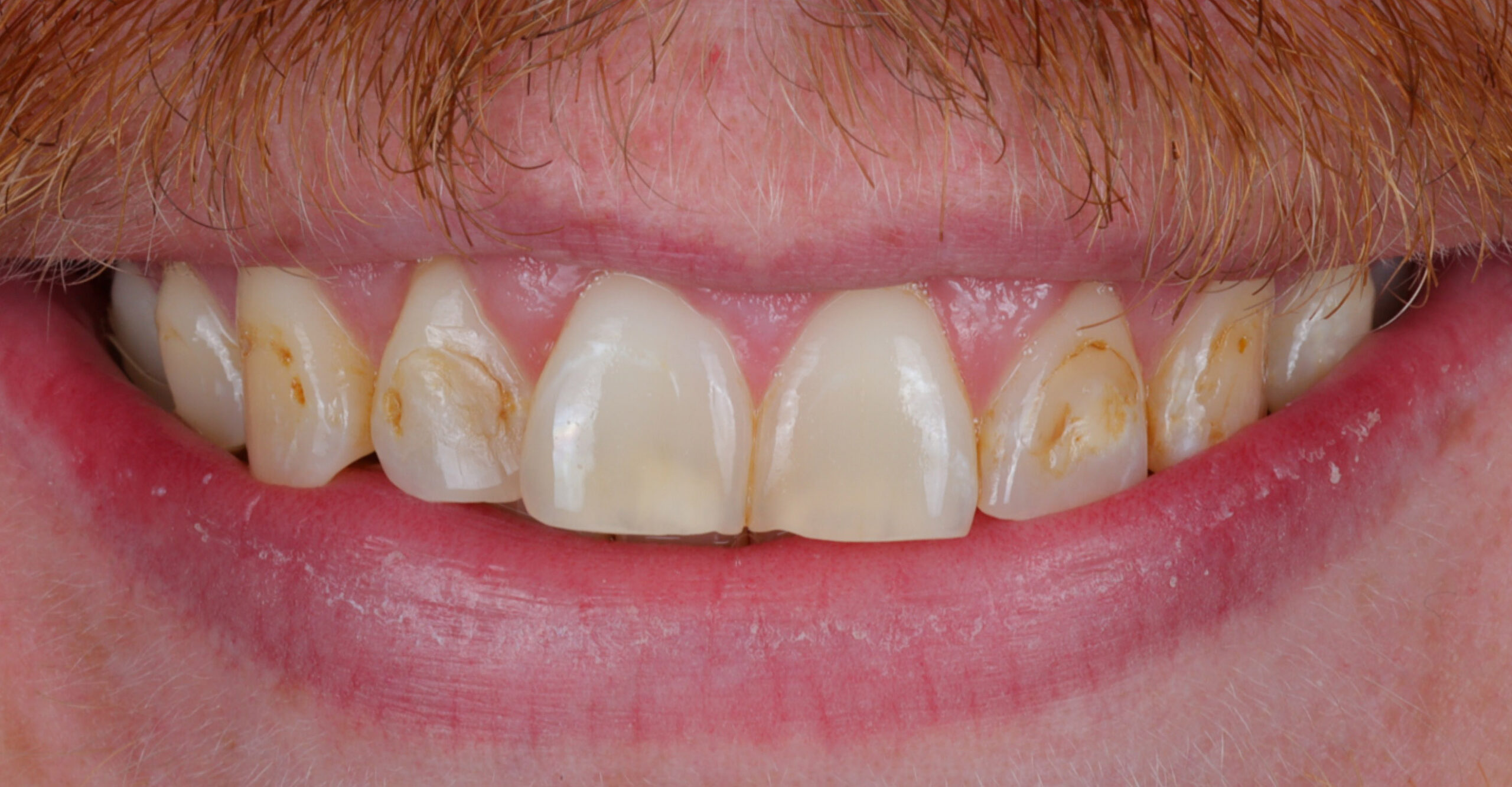 Family Dentistry of Forest Hill | Smile Gallery