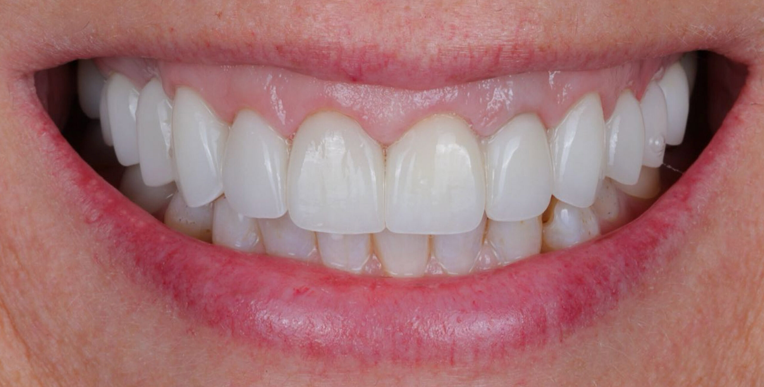 Family Dentistry of Forest Hill | Smile Gallery