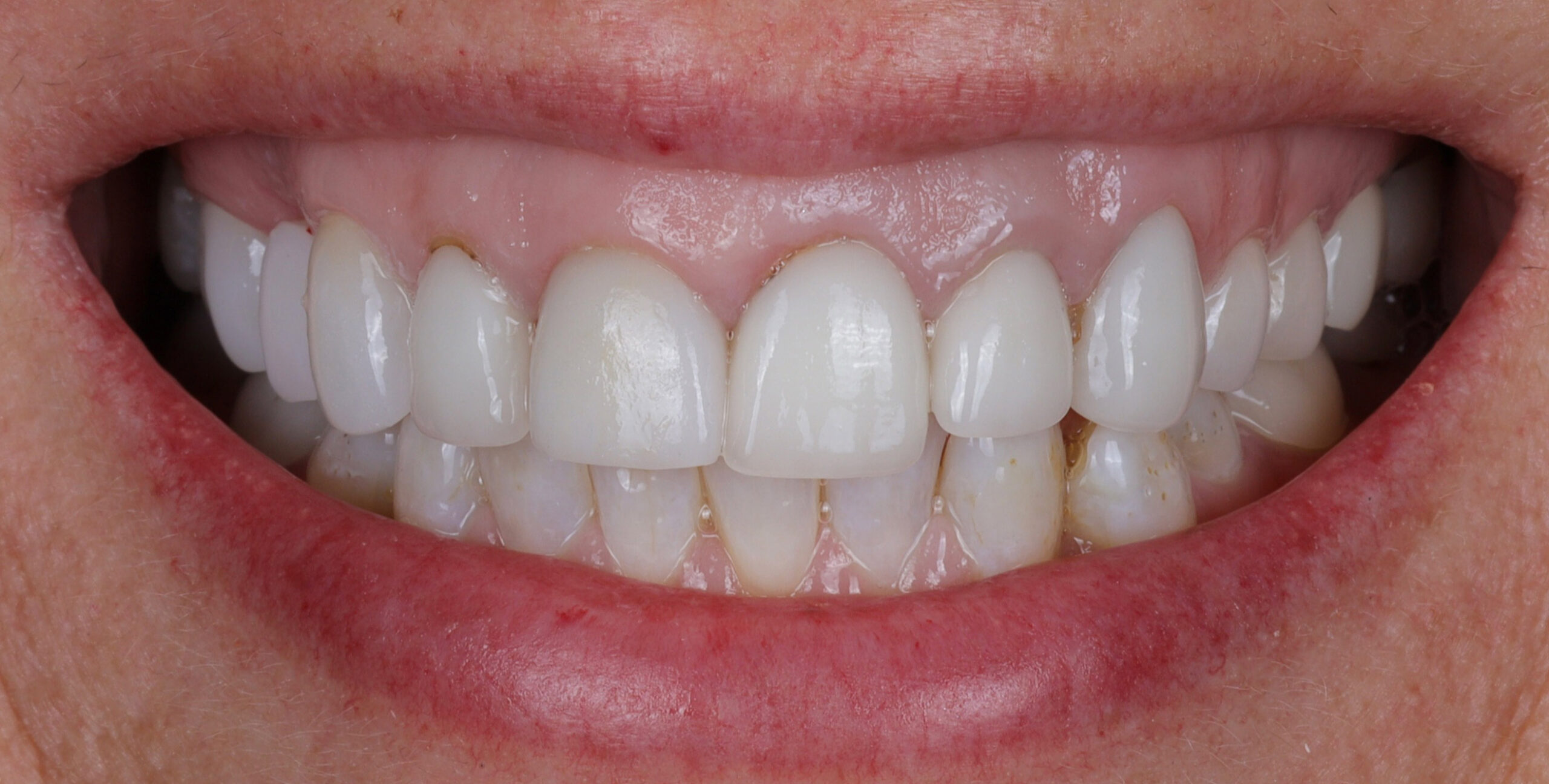 Family Dentistry of Forest Hill | Smile Gallery