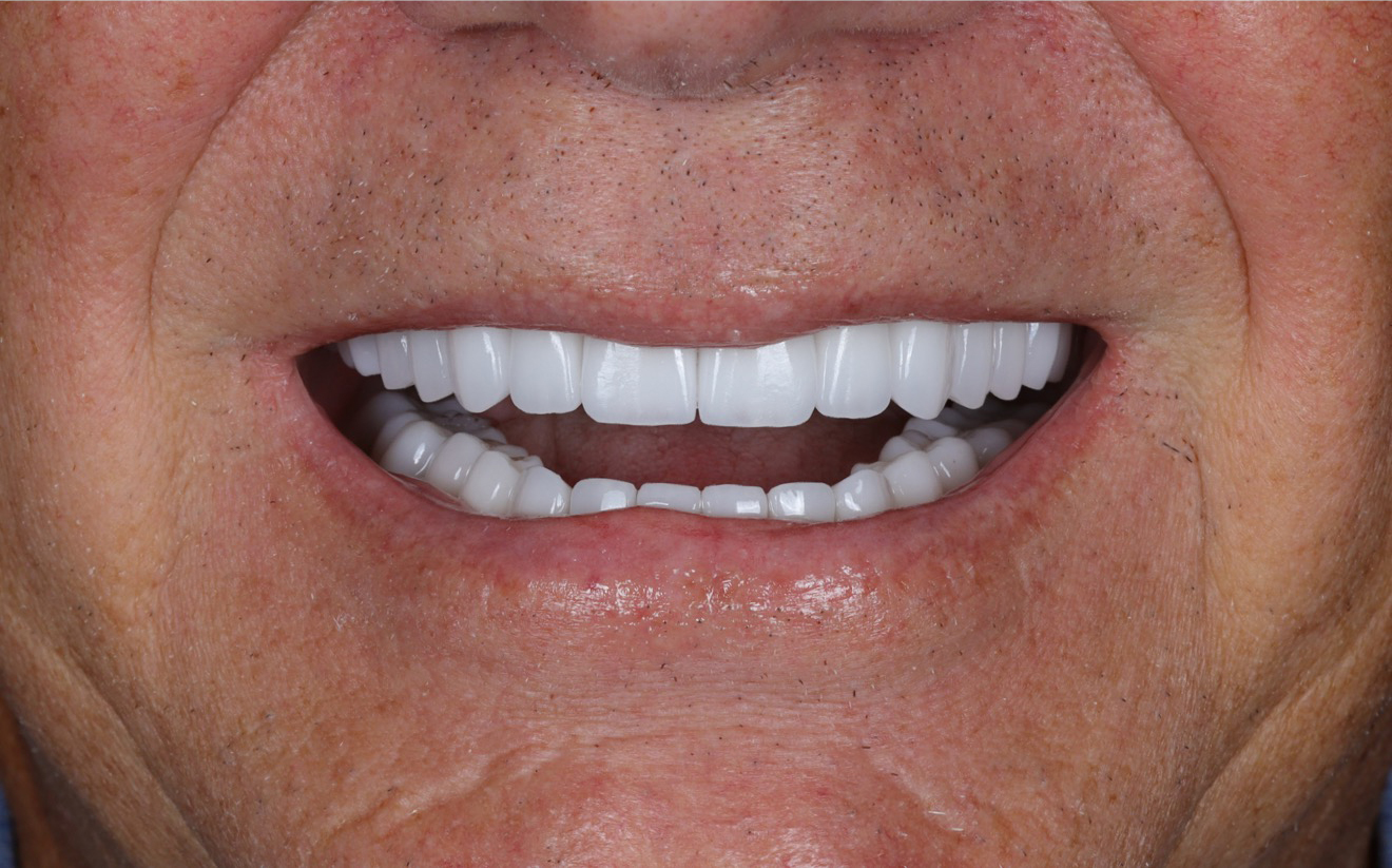 Family Dentistry of Forest Hill | Smile Gallery