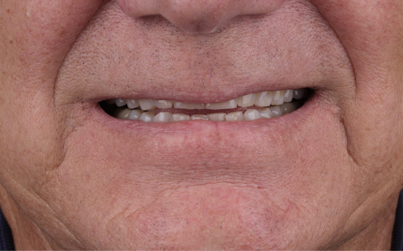 Family Dentistry of Forest Hill | Smile Gallery