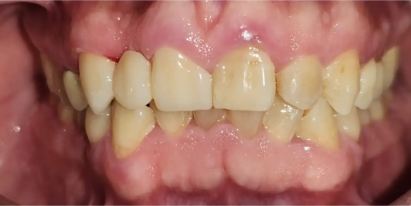 Family Dentistry of Forest Hill | Smile Gallery