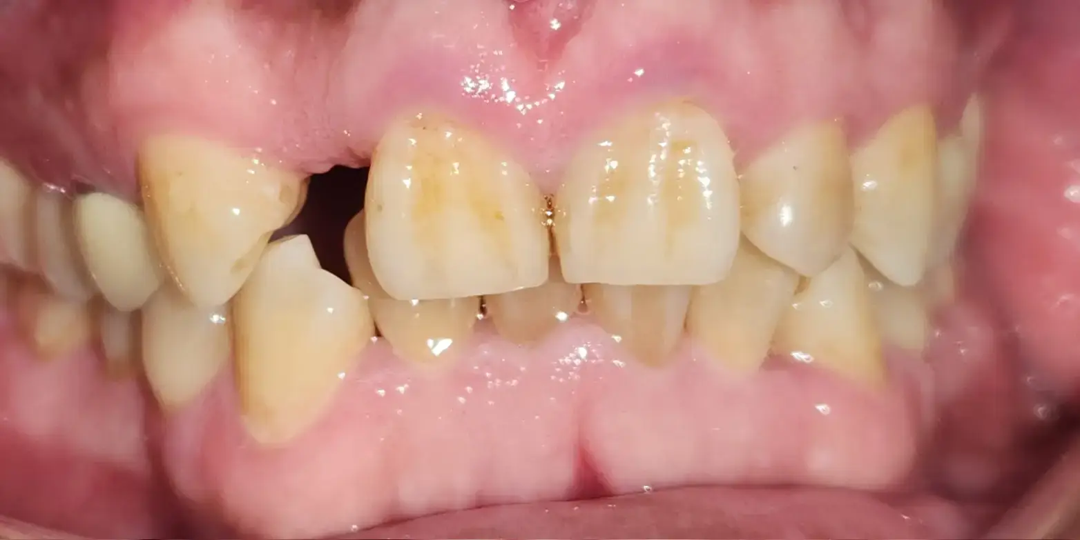 Family Dentistry of Forest Hill | Smile Gallery