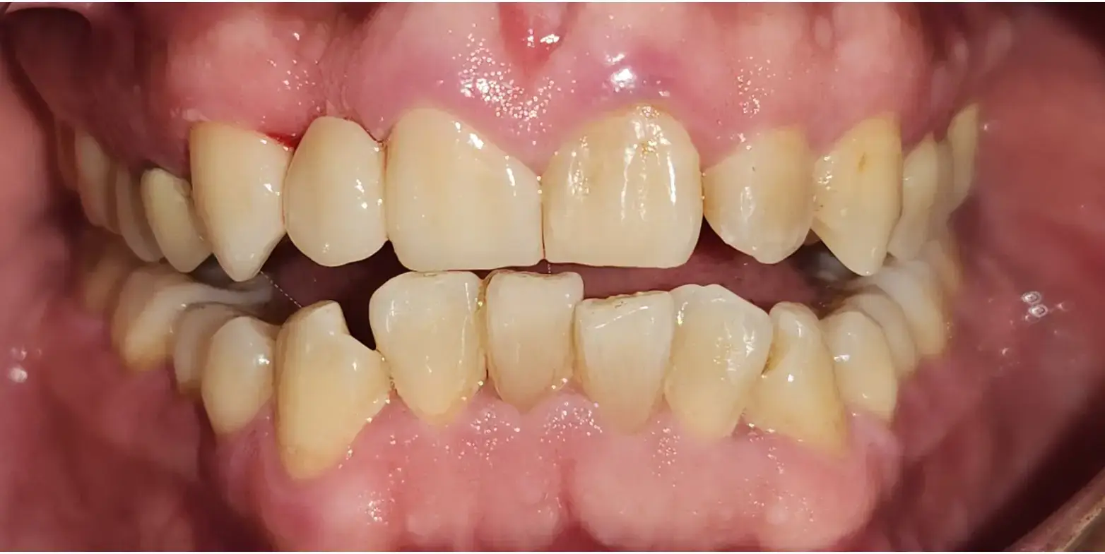 Family Dentistry of Forest Hill | Smile Gallery