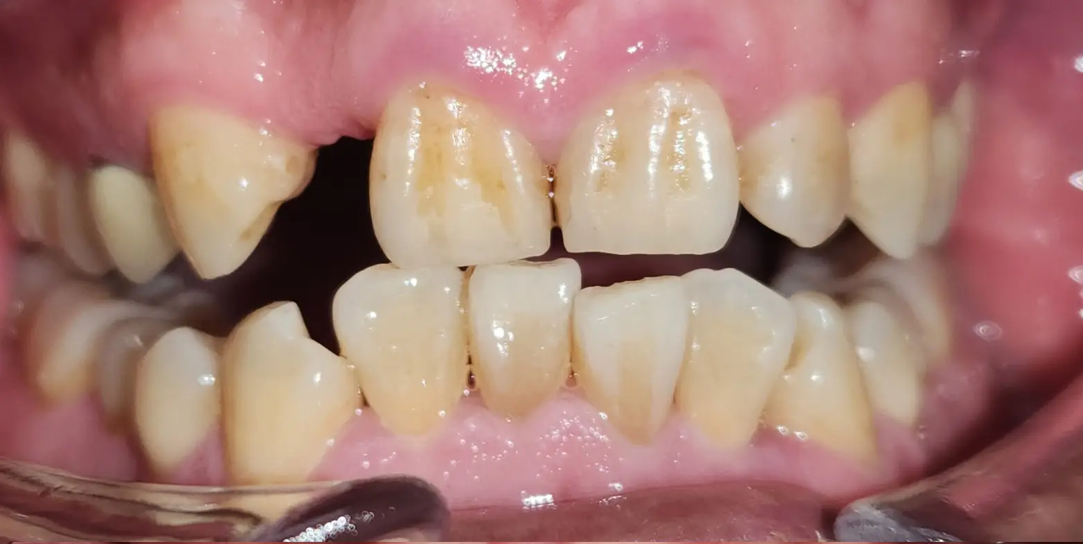 Family Dentistry of Forest Hill | Smile Gallery