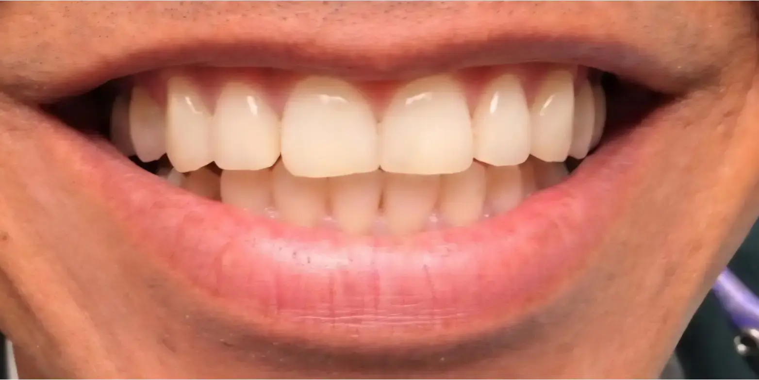 Family Dentistry of Forest Hill | Smile Gallery
