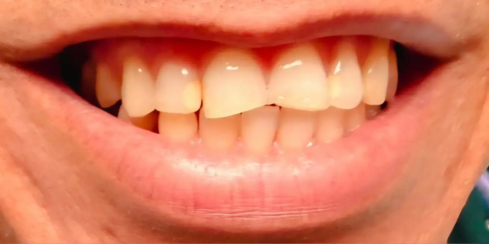 Family Dentistry of Forest Hill | Smile Gallery