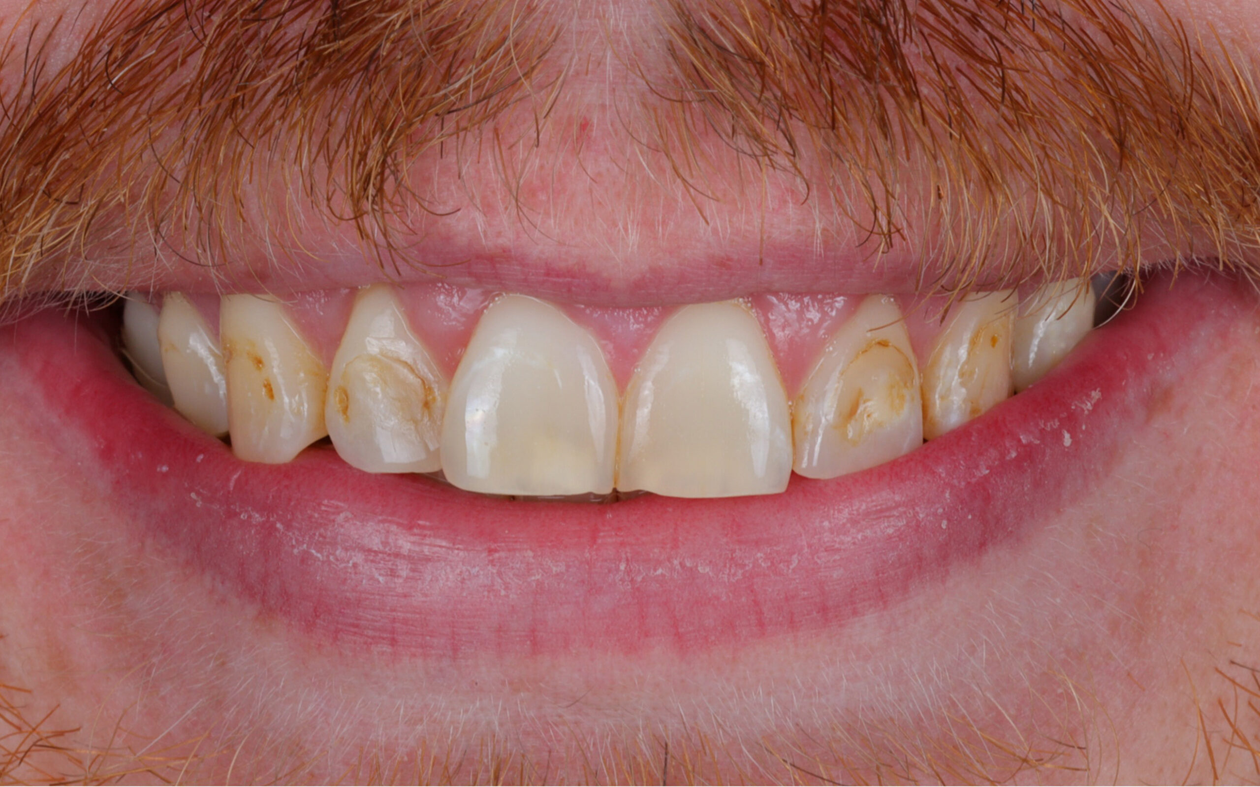 Family Dentistry of Forest Hill | Smile Gallery