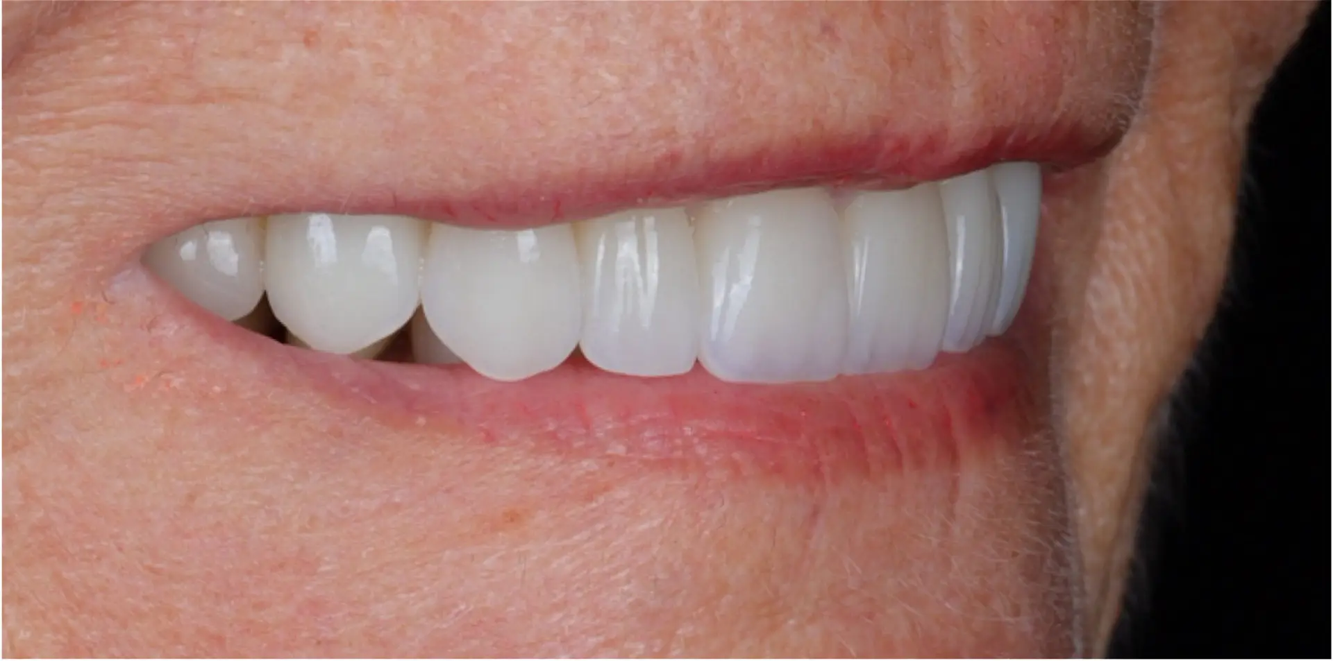Family Dentistry of Forest Hill | Smile Gallery
