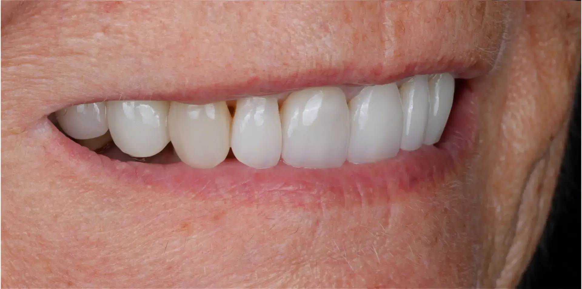 Family Dentistry of Forest Hill | Smile Gallery
