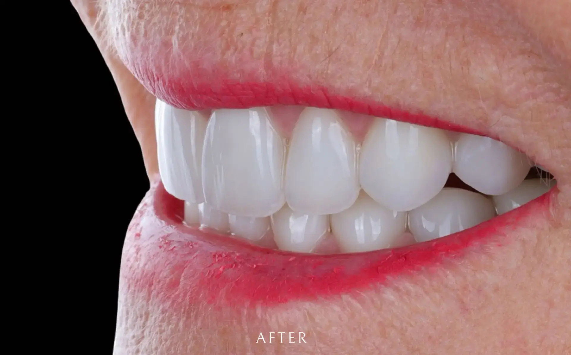 Family Dentistry of Forest Hill | Smile Gallery