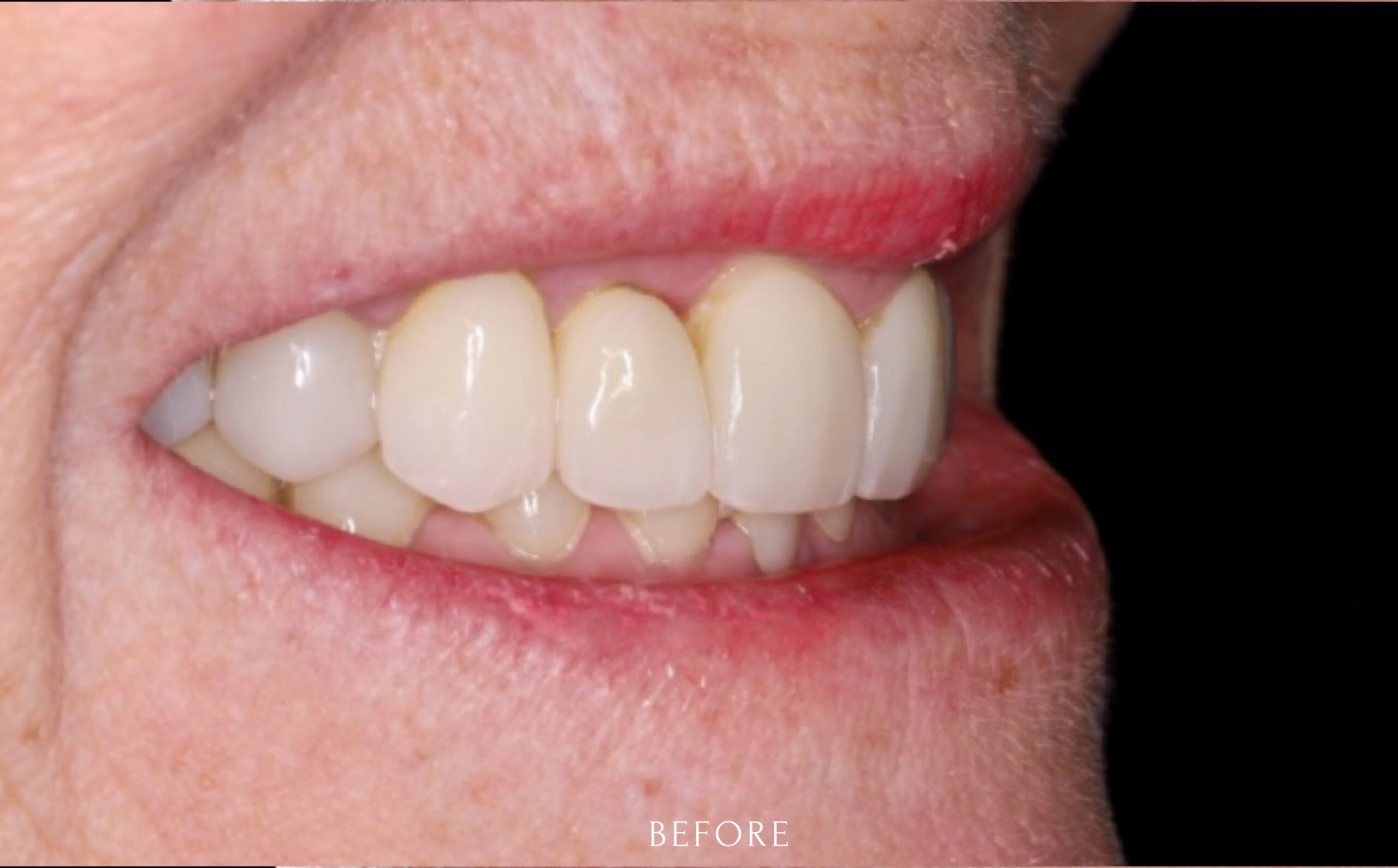 Family Dentistry of Forest Hill | Smile Gallery