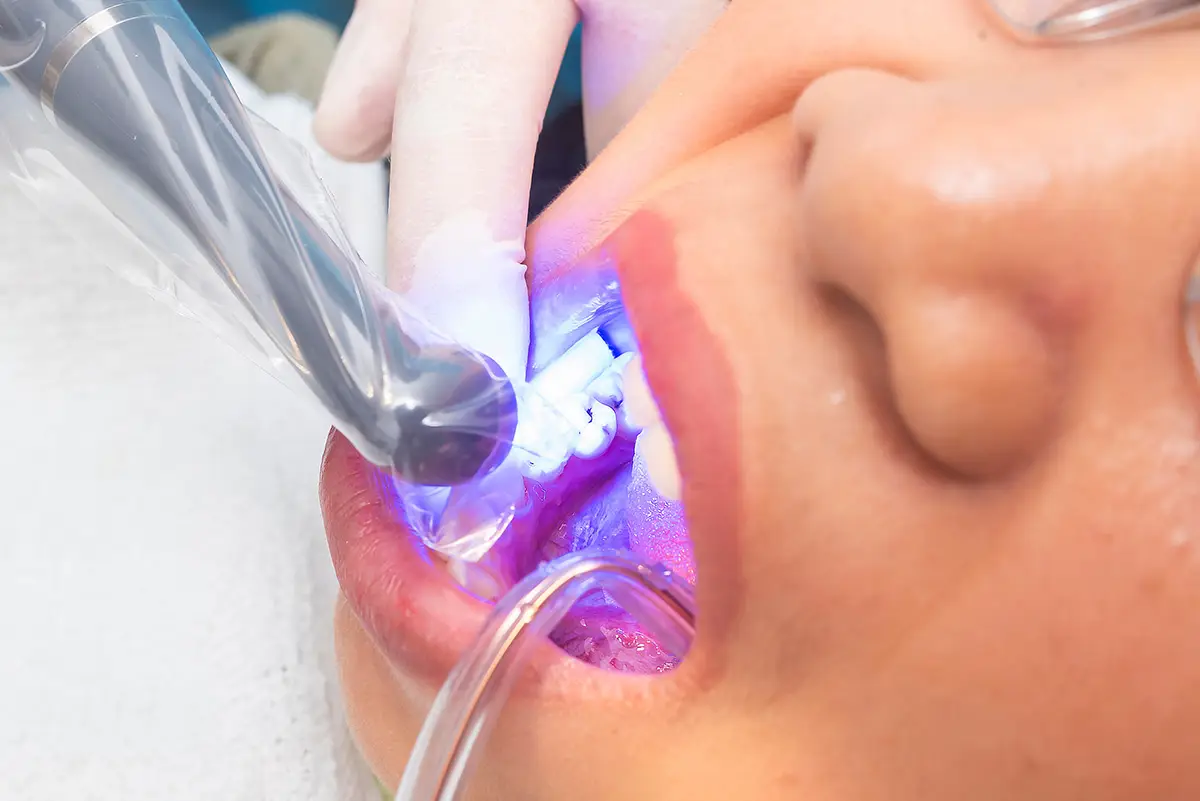 Family Dentistry of Forest Hill | General Dentistry