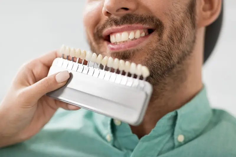 Family Dentistry of Forest Hill | Dental Veneers