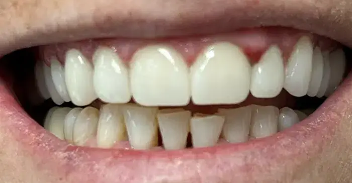 Family Dentistry of Forest Hill | Smile Gallery