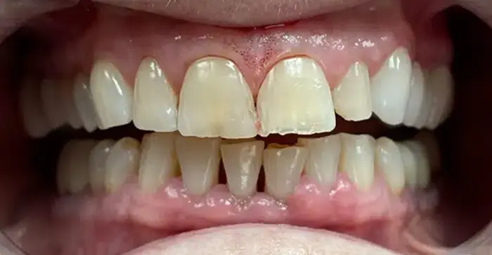 Family Dentistry of Forest Hill | Smile Gallery
