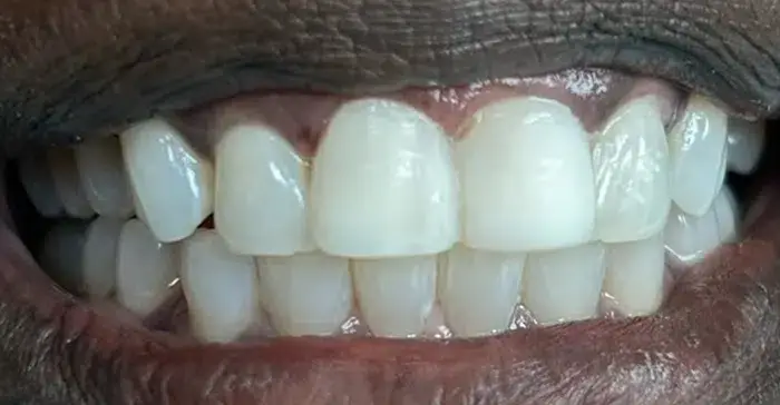 Family Dentistry of Forest Hill | Smile Gallery