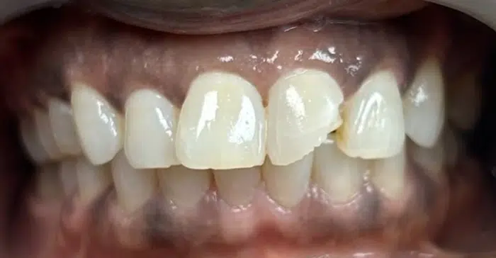 Family Dentistry of Forest Hill | Smile Gallery