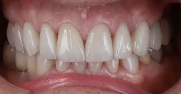 Family Dentistry of Forest Hill | Smile Gallery
