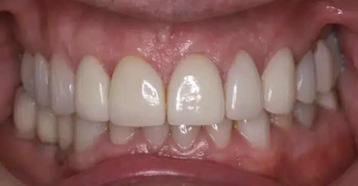 Family Dentistry of Forest Hill | Smile Gallery