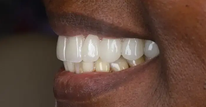 Family Dentistry of Forest Hill | Smile Gallery