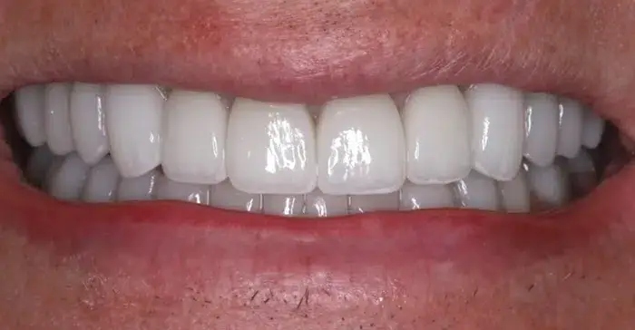 Family Dentistry of Forest Hill | Smile Gallery