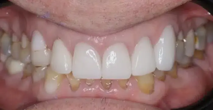 Family Dentistry of Forest Hill | Smile Gallery