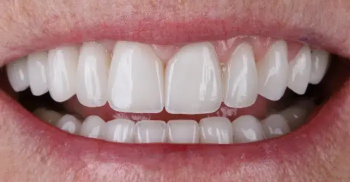 Family Dentistry of Forest Hill | Smile Gallery