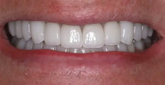 Family Dentistry of Forest Hill | Smile Gallery