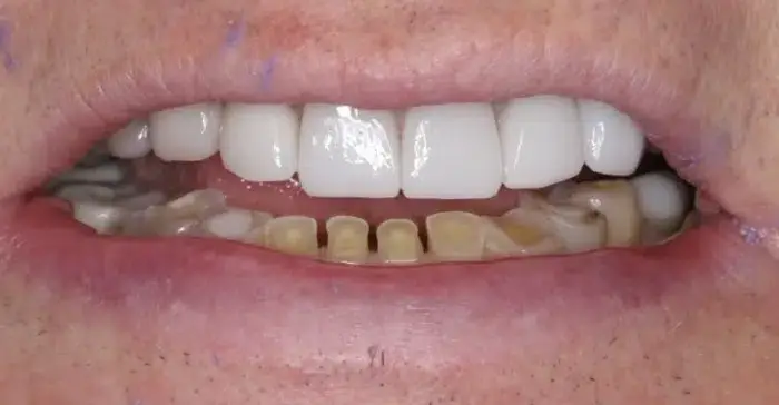 Family Dentistry of Forest Hill | Smile Gallery