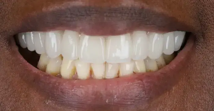 Family Dentistry of Forest Hill | Smile Gallery