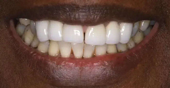Family Dentistry of Forest Hill | Smile Gallery