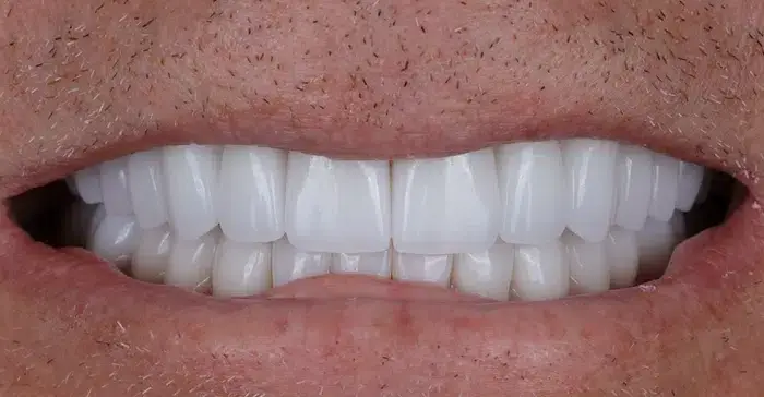Family Dentistry of Forest Hill | Smile Gallery