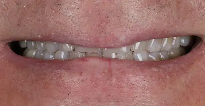 Family Dentistry of Forest Hill | Smile Gallery